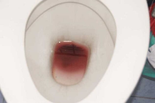 manchado en los hombres cuando están excitados